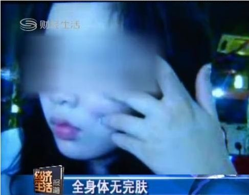 桑拿女被男友虐待48小时 <em>变态性虐</em>烟头烫乳房