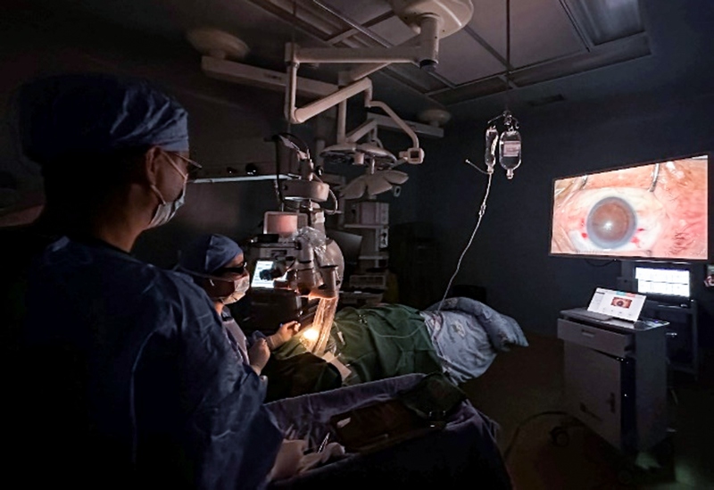 利用3D高清眼科手術成像系統，開展白內障超聲乳化摘除並人工晶狀體植入術。浙畢醫院供圖