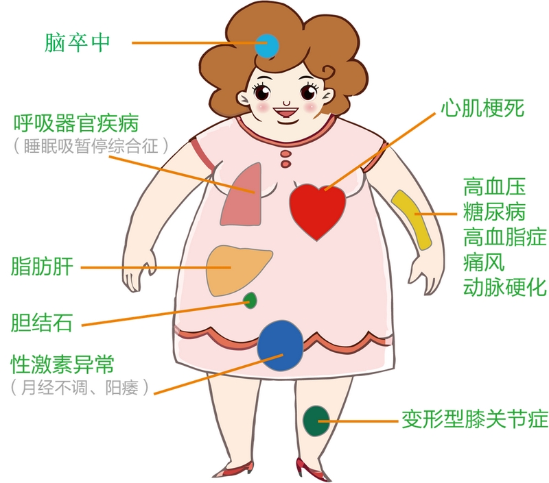 肥胖易引发的疾病。